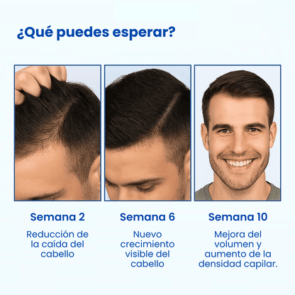 Suero anticaída Venune