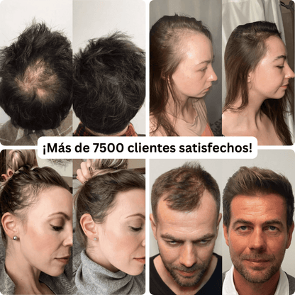 Suero anticaída Venune